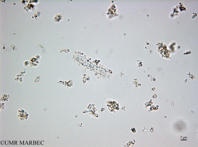 phyto/Bizerte/bizerte_bay/RISCO February 2015/Cymatopleura sp1 (ancien Baie_T5_CW1_Pennée_grande160127_001_ovl).TIF(copy)_thumb.jpg